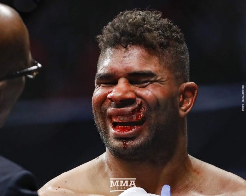 ¡Terribles fotos! De un brutal golpe le rompen los labios a un peleador en la UFC