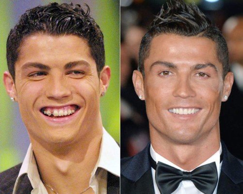 ¡BRUTAL! Los 12 jugadores que sorprendieron con sus cambios radicales