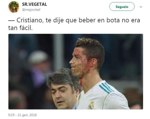 ¡VIRAL! Los memes de Cristiano Ronaldo por mirar su herida en el celular