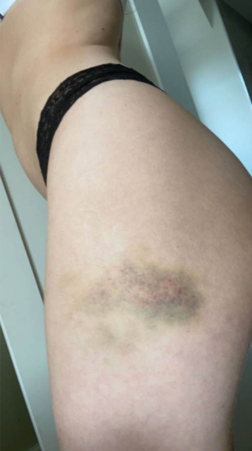 Escándalo en la Premier League: influencer filtra imágenes de la violencia que sufre por parte de jugador del Manchester United