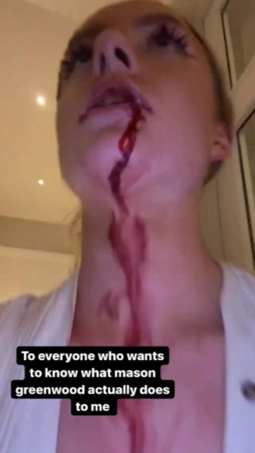 Escándalo en la Premier League: influencer filtra imágenes de la violencia que sufre por parte de jugador del Manchester United