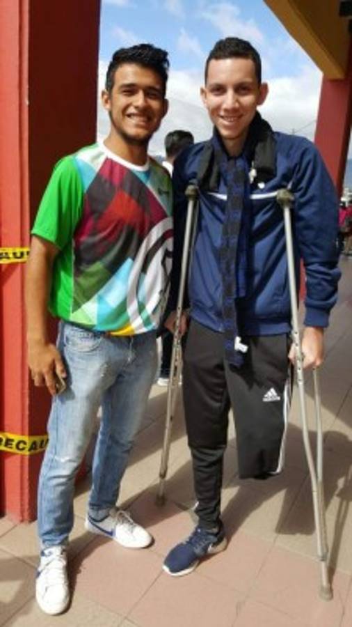 Luis Diego Jiménez, el futbolista hondureño que sonríe a pesar de haber perdido una pierna