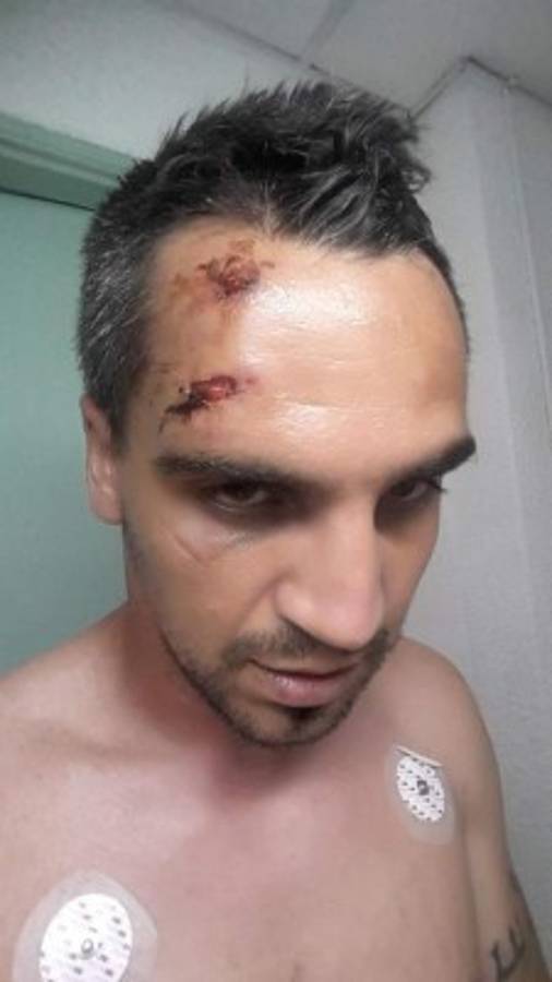 FOTOS: Así quedaron Yul Arzú y Portigliatti tras el Motagua-Juticalpa