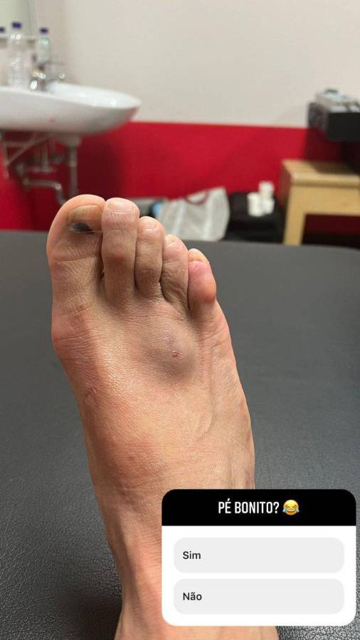 ¡Al descubierto! Así son los pies más feos de algunos deportistas reconocidos a nivel mundial; los de CR7 y Lebron son horribles