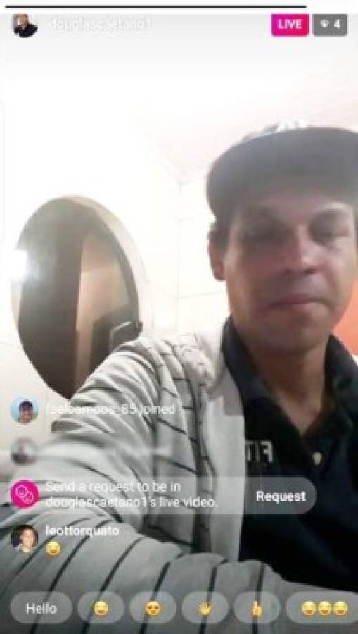Douglas Caetano aparece en un Live de Instagram y sorprende con su maltratada apariencia