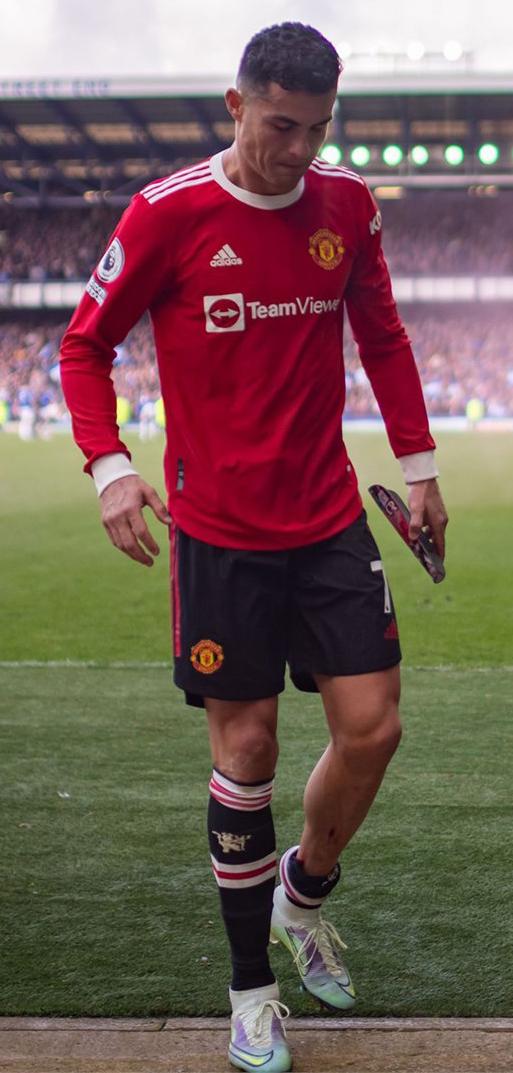 Escalofriante: así le quedó la pierna a Cristiano Ronaldo en la dolorosa derrota del Manchester United