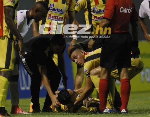 CURIOSAS: El 'nocaut' a Allans Vargas y el agarrón de pelo de César Oseguera a Yeer