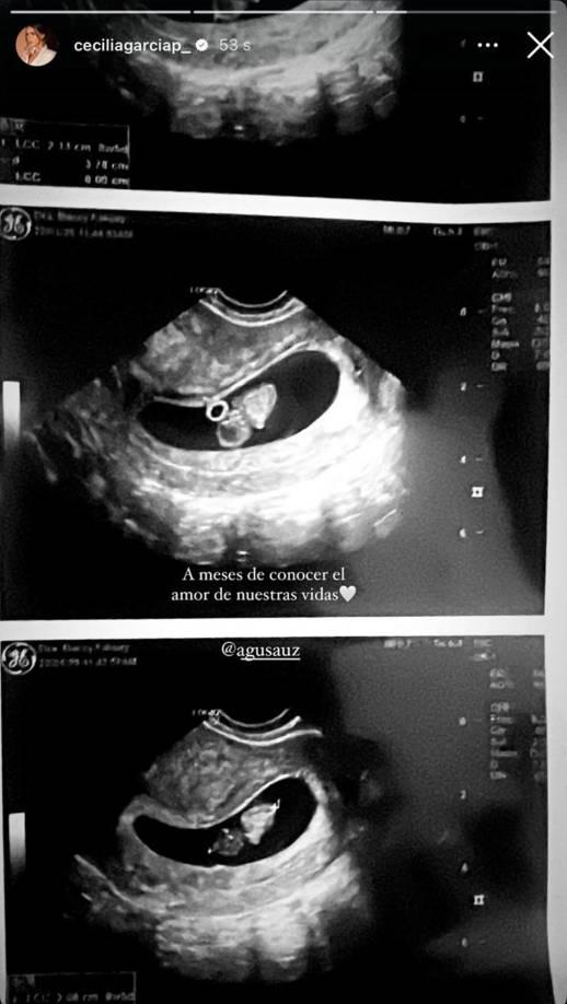 ¿Se va para Argentina?: así confirmó Cecilia García que está embarazada de Agustín Auzmendi, ex Motagua