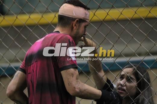 Lo que pasó durante el apagón en el Olímpico, el viral gesto de un jugador lesionado y su esposa y el momentazo entre Troglio-Keosseián