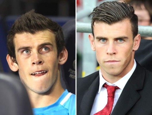 Futbolistas que recurrieron al bisturí para mejorar su apariencia física