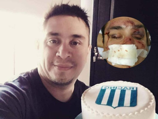 Aficionados de Racing de Argentina propinan paliza a un periodista