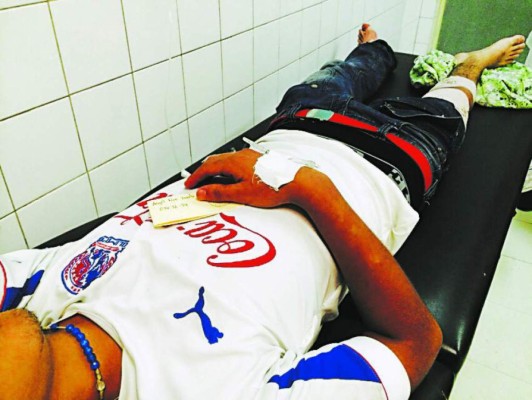 Casos de violencia que involucran a aficionados de clubes en Honduras