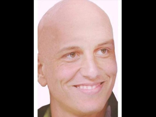 FOTOS: Este es el club de los pelones del deporte