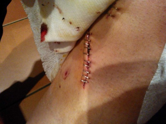 Las espeluznantes y temibles operaciones a los futbolistas