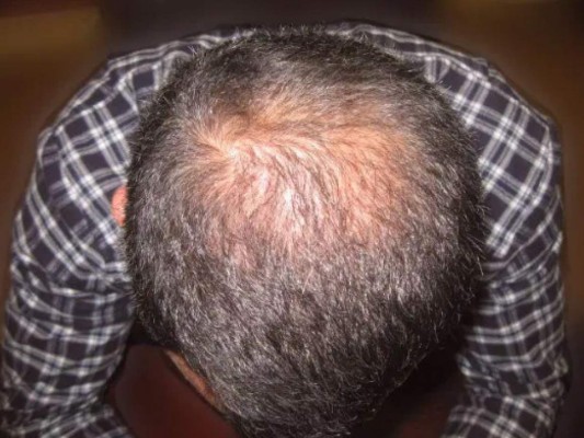 El trauma que sufrió Ryan Giggs por alcanzar la fama con el Manchester United