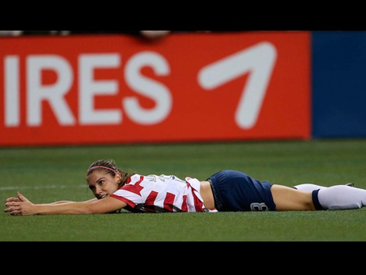 Las distracciones más ardientes que se han visto de Alex Morgan