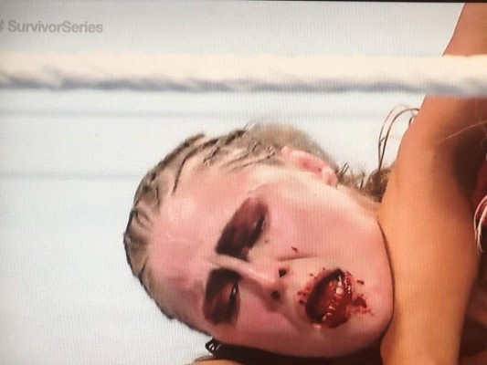 La sangrienta paliza que recibió Ronda Rousey en la WWE por Charlotte Flair