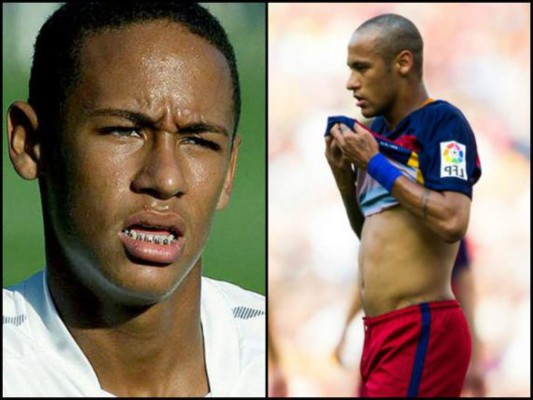 FOTOS: Este es el club de los pelones del deporte