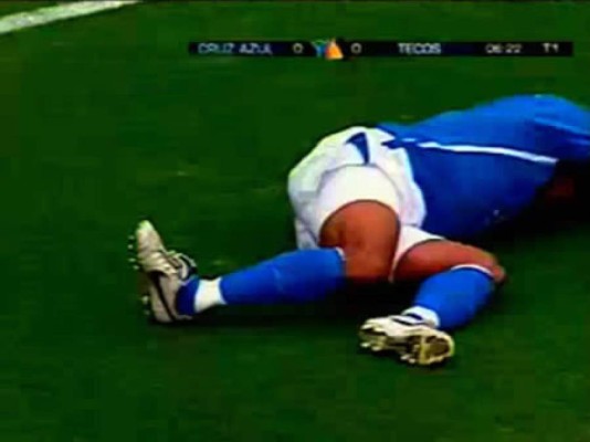 Estas son las lesiones más terribles en la historia del fútbol