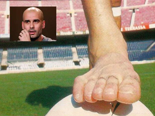 ¡HORRIBLES! Así son los pies más feos de los deportistas famosos