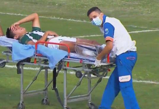 Insólita y escalofriante lesión en Argentina: el delantero cae sobre el rival tras recibir un pelotazo y le rompió la pierna