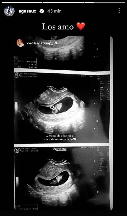 ¿Se va para Argentina?: así confirmó Cecilia García que está embarazada de Agustín Auzmendi, ex Motagua