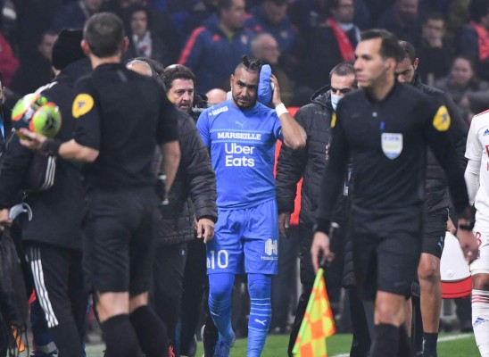 Fotos: Así fue la agresión que sufrió Payet en la Liga de Francia; ¡botellazo en la cabeza!