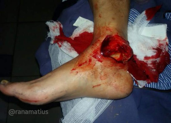 Las espeluznantes y temibles operaciones a los futbolistas