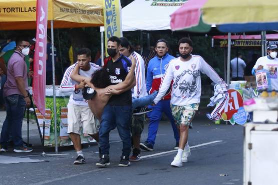 Aficionados del Olimpia cuando pedían atención médica al salir heridos de bala durante el choque de barras en el estadio Morazán.