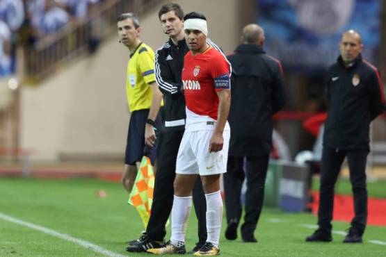 Monaco's Colombian forward Radamel Falcao (3rd-R) looks on with a band-aid on the head during the UEFA Champions League Group G football match AS Monaco FC vs FC Porto on September 26, 2017 at the Louis II stadium in Monaco. / AFP PHOTO / Valery HACHE