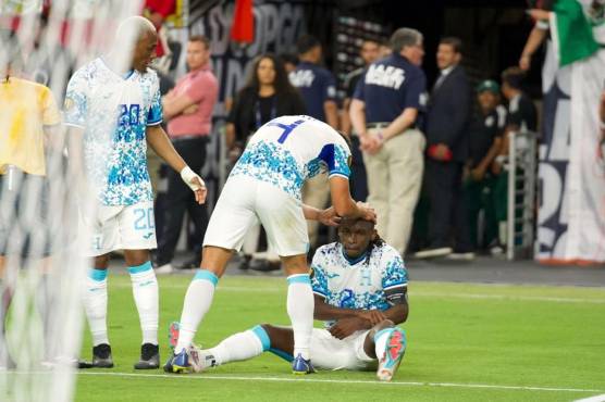 Alberth Elis se fracturó el brazo cuando anotó el empate ante Qatar en la Copa Oro.