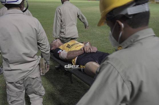 ¡Terrible! Omar Rosas se lesiona el codo derecho y su presencia en la final del Clausura 2022 puede estar en duda