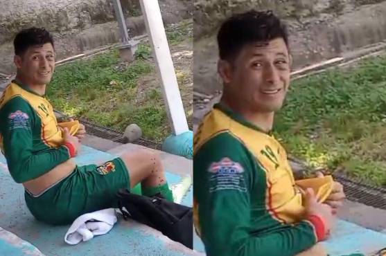 Así quedó el ojo de Noel Valladares tras sufrir terrible codazo.