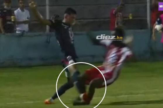 La durísima falta de Juan Delgado contra Anthony García.