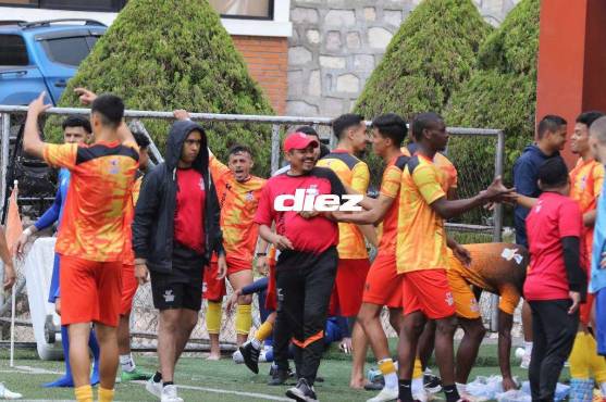 Ezequiel Silveira, el uruguayo que fue campeón con Espinel, fue fichado por la UPNFM ¿qué lo ha sorprendido?