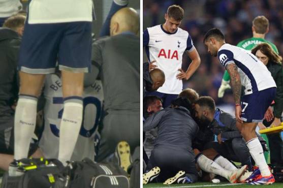 Ocupó oxigeno y los compañeros no lo creían: Jugador sufrió escalofriante golpe en la cabeza en el Leicester-Tottenham