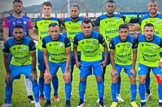 Allan “El Pilín” Cárcamo es el defensa central habitual de los Potros de Olancho.