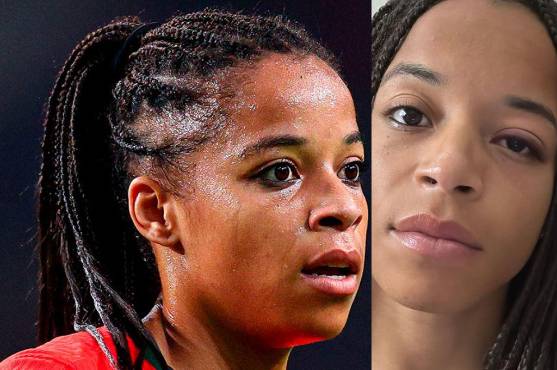 Perdió la visión por un pelotazo en la cara y revela lo que le dijo el oftalmólogo: “no sé cuándo podré volver a jugar”