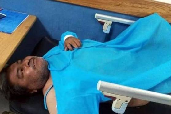 El ‘Maradonita’ Cruz fue ingresado al Catarino tras ser embestido por un carro.