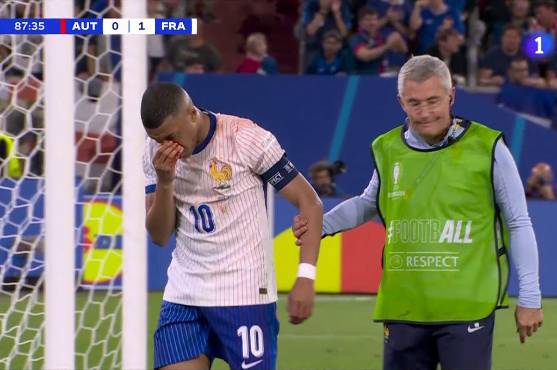 Mbappé reacciona y confirma su futuro en la Eurocopa con Francia tras sufrir el duro golpe en su nariz