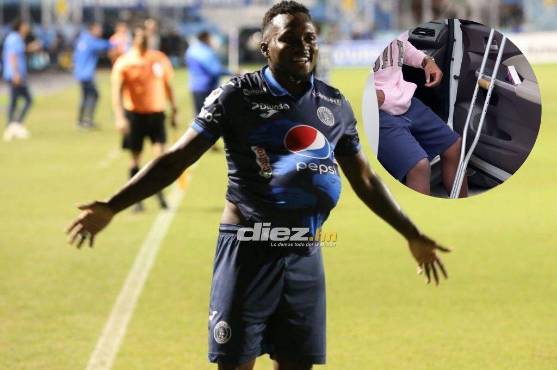 Confirmado: Motagua sufre sensible baja para el partido de ida ante Marathón por las semifinales de Liga Nacional