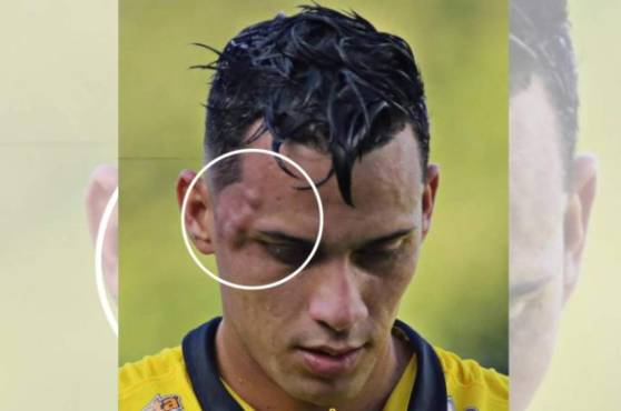 Tejeda salió expulsado y con un fuerte golpe en su rostro.