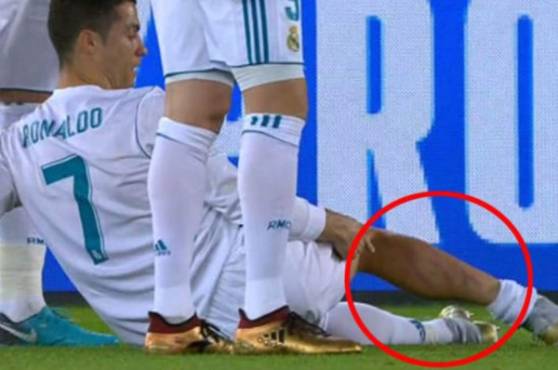 El mexicano César Ramos no castigó con tarjeta la grave falta que le han hecho a Cristiano.