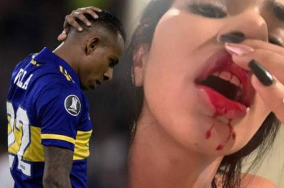 Exnovia de Sebastián Villa: ‘’Perdí un embarazo por los golpes que me había dado’’