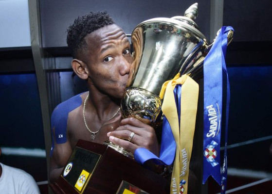 ¡Capturadas en el momento! 15 fotos que quizás nunca viste del Olimpia &nbsp;&nbsp;