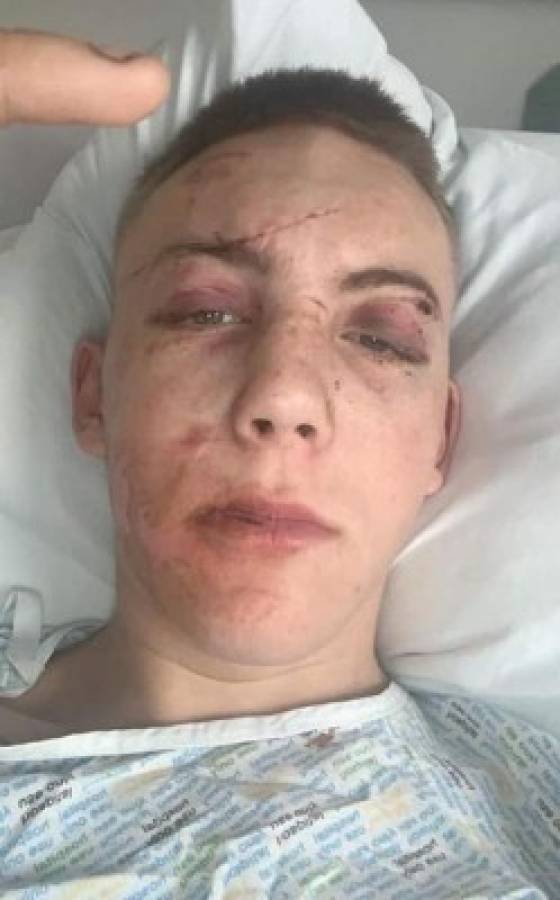Cara desfigurada y huesos rotos: La paliza que le dieron a un soldado tras ser secuestrado en una cita de Tinder