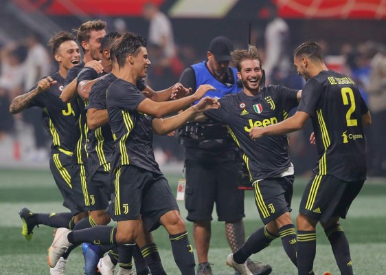CURIOSAS: Los gestos de Elis y el festejo de Juventus en juego de Estrellas de MLS