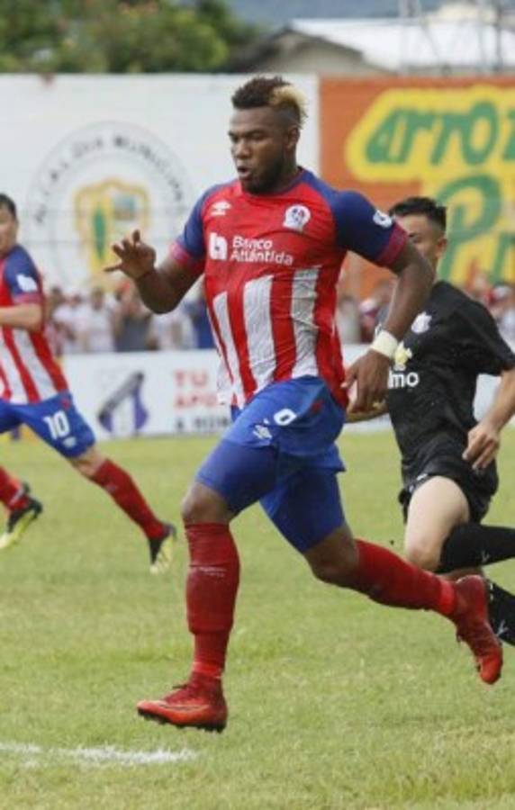 ¡Con 10 ausencias! Pedro Troglio confirma el 11 titular de Olimpia ante Forge FC