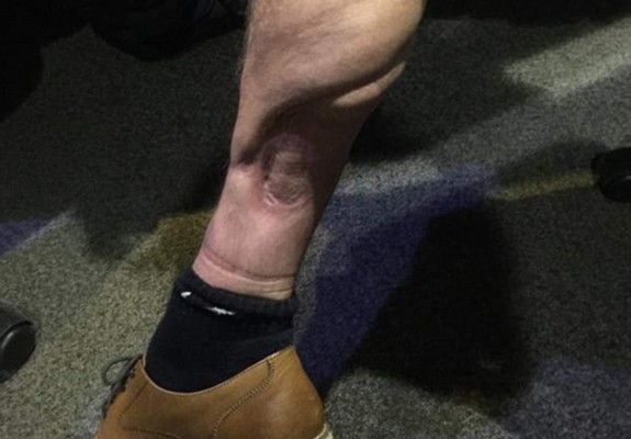 Estas son las lesiones más terribles en la historia del fútbol