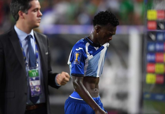 LO QUE NO SE VIO: El barbón, el espontáneo y el sufrimiento de Honduras